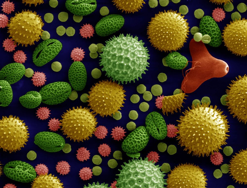 Electron microscope image of pollen grains from several plant species